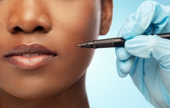 Pre Plastic Surgery To-Do List
